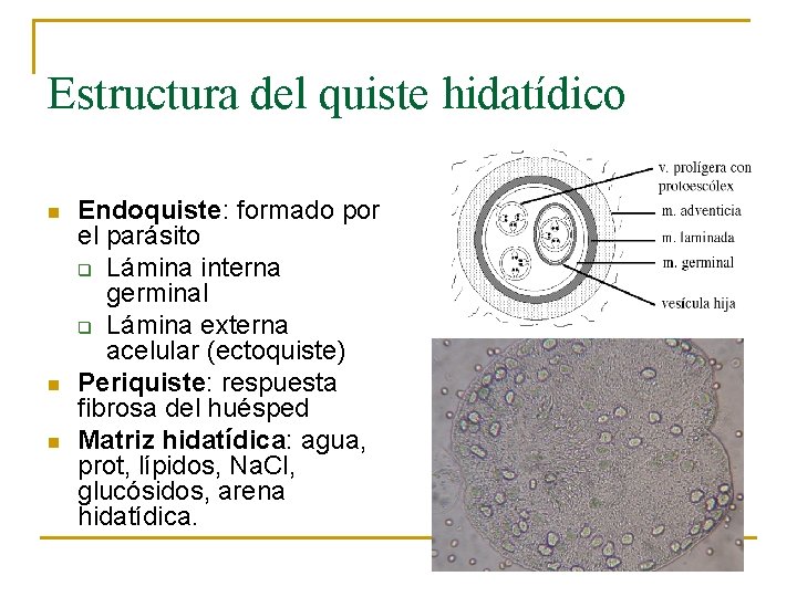 Estructura del quiste hidatídico n n n Endoquiste: formado por el parásito q Lámina