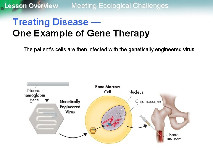 Lesson Overview Meeting Ecological Challenges Treating Disease — One Example of Gene Therapy The