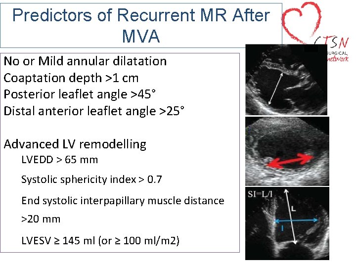 Predictors of Recurrent MR After MVA No or Mild annular dilatation Coaptation depth >1
