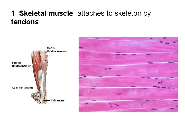 1. Skeletal muscle- attaches to skeleton by tendons 1. Skeletal muscle- attaches to skeleton by tendons