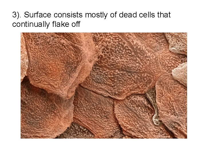 3). Surface consists mostly of dead cells that continually flake off 3). Surface consists mostly of dead cells that continually flake off