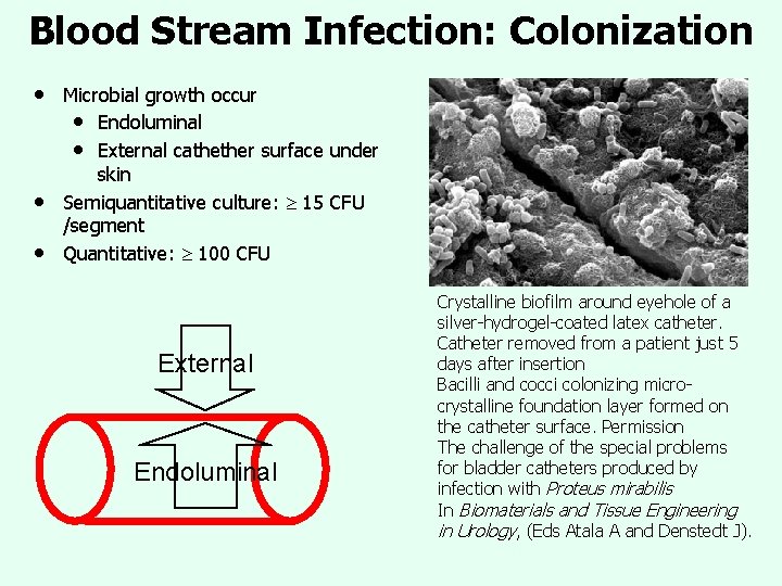 Blood Stream Infection: Colonization • • • Microbial growth occur • Endoluminal • External Blood Stream Infection: Colonization • • • Microbial growth occur • Endoluminal • External