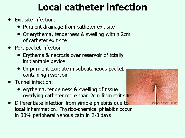 Local catheter infection • • Exit site infection: • Purulent drainage from catheter exit Local catheter infection • • Exit site infection: • Purulent drainage from catheter exit