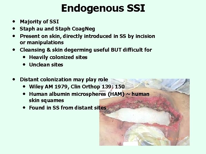 Endogenous SSI • • • Majority of SSI Staph au and Staph Coag. Neg Endogenous SSI • • • Majority of SSI Staph au and Staph Coag. Neg
