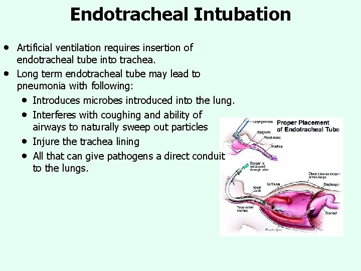 Endotracheal Intubation • • Artificial ventilation requires insertion of endotracheal tube into trachea. Long Endotracheal Intubation • • Artificial ventilation requires insertion of endotracheal tube into trachea. Long