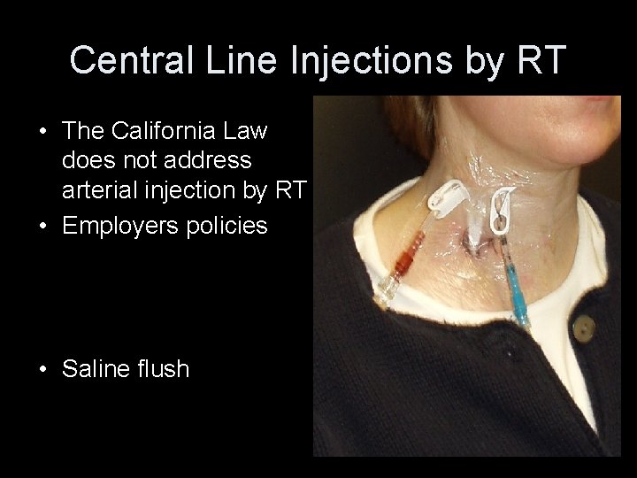 Central Line Injections by RT • The California Law does not address arterial injection