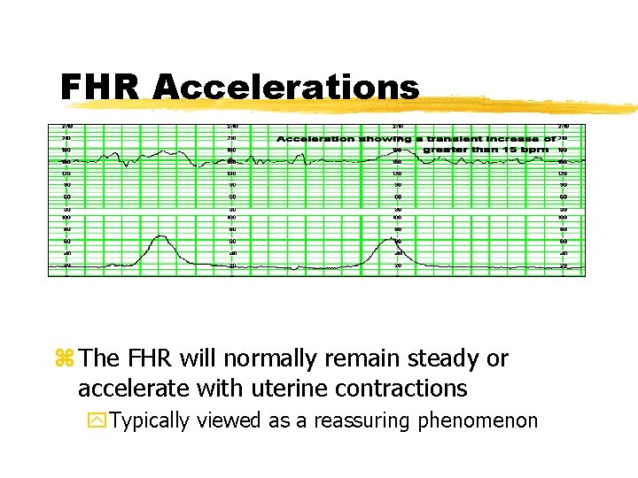 FHR Accelerations z The FHR will normally remain steady or accelerate with uterine contractions