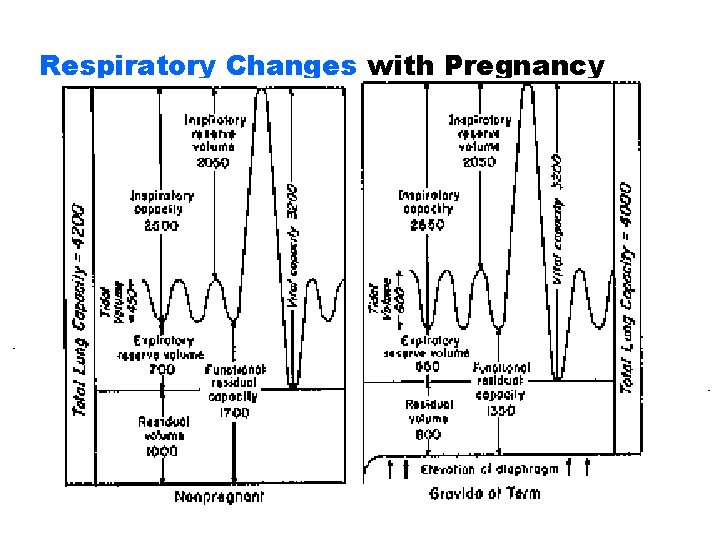 Respiratory Changes with Pregnancy 