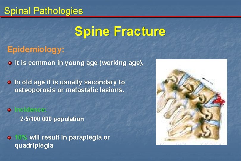 Spinal Pathologies Spine Fracture Epidemiology: It is common in young age (working age). In