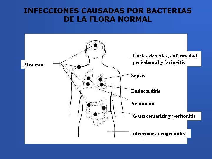 INFECCIONES CAUSADAS POR BACTERIAS DE LA FLORA NORMAL Abscesos Caries dentales, enfermedad periodontal y