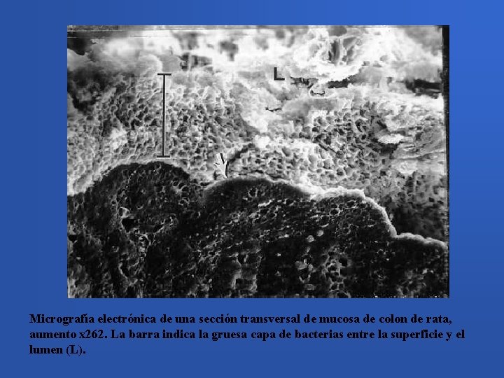 Micrografía electrónica de una sección transversal de mucosa de colon de rata, aumento x