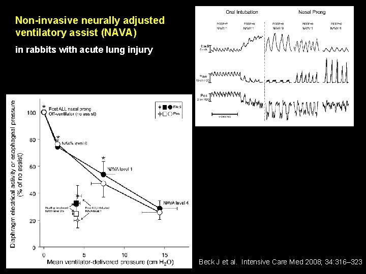Non-invasive neurally adjusted ventilatory assist (NAVA) in rabbits with acute lung injury Beck J