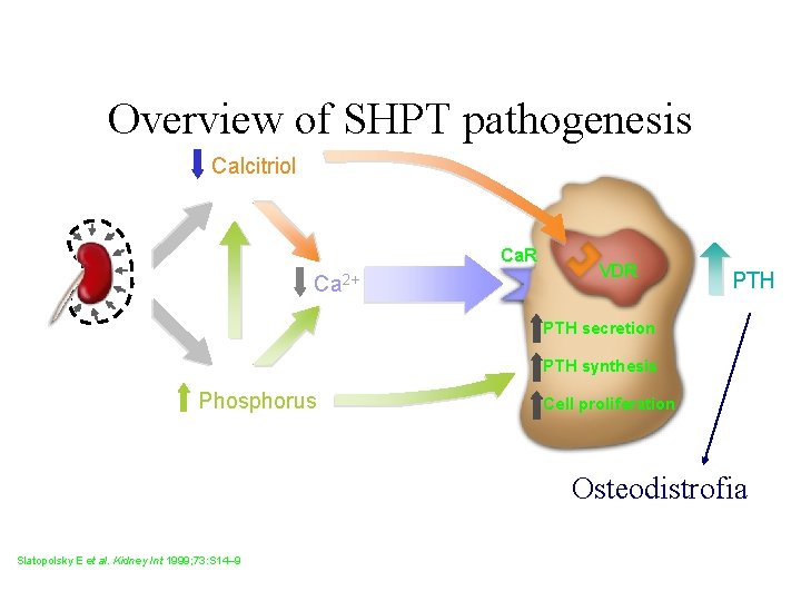 Overview of SHPT pathogenesis Calcitriol Ca. R Ca 2+ VDR PTH secretion PTH synthesis Overview of SHPT pathogenesis Calcitriol Ca. R Ca 2+ VDR PTH secretion PTH synthesis