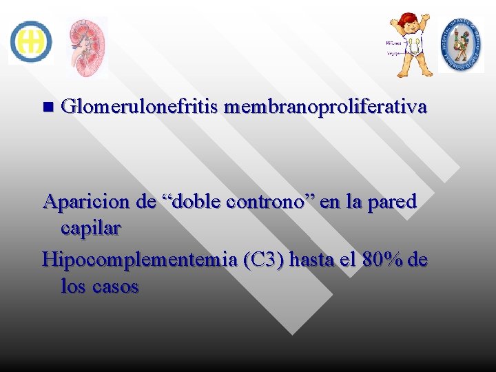 n Glomerulonefritis membranoproliferativa Aparicion de “doble controno” en la pared capilar Hipocomplementemia (C 3)