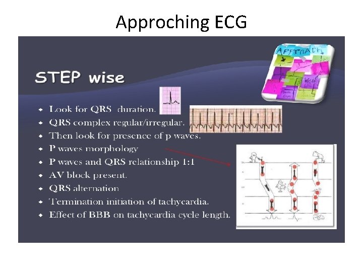 Approching ECG 