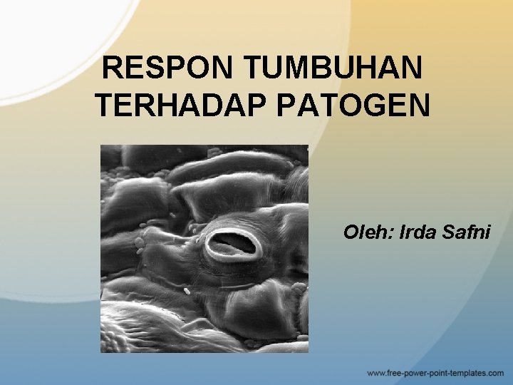 RESPON TUMBUHAN TERHADAP PATOGEN Oleh: Irda Safni 