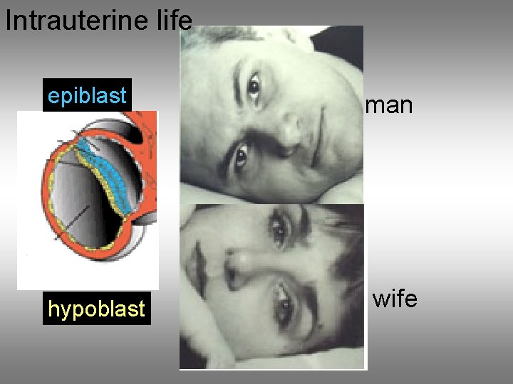 Intrauterine life epiblast hypoblast man wife 