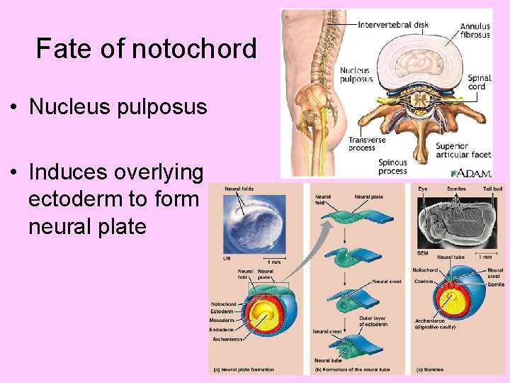 Fate of notochord • Nucleus pulposus • Induces overlying ectoderm to form neural plate