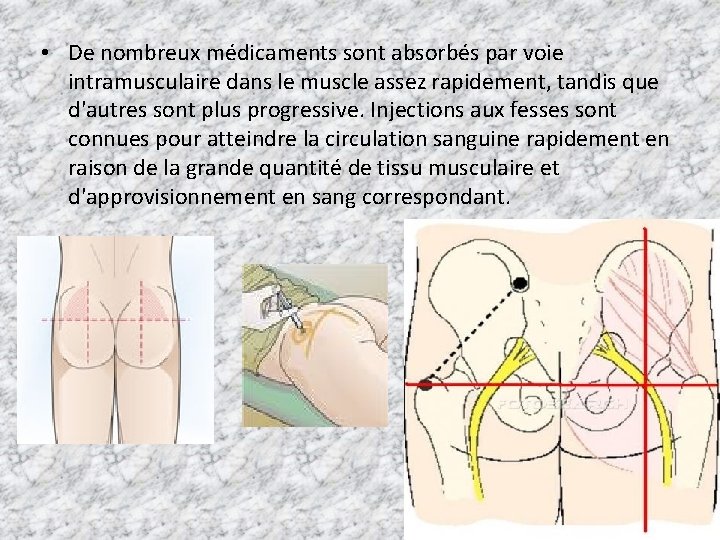  • De nombreux médicaments sont absorbés par voie intramusculaire dans le muscle assez