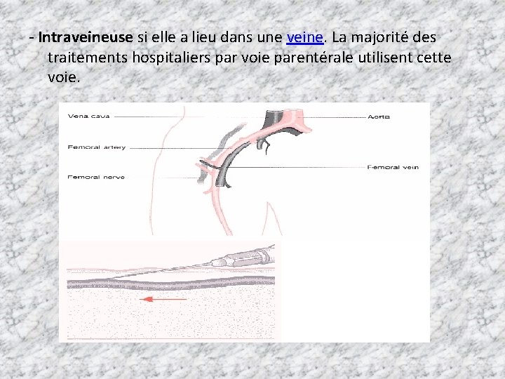 - Intraveineuse si elle a lieu dans une veine. La majorité des traitements hospitaliers