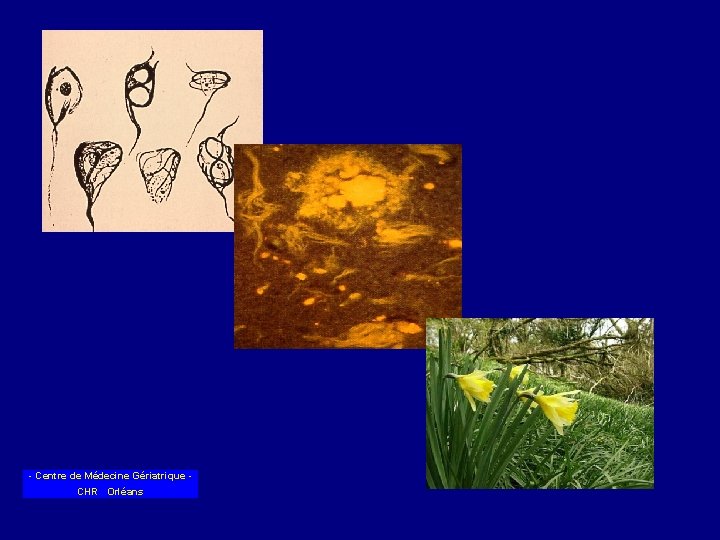 - Centre de Médecine Gériatrique CHR Orléans 