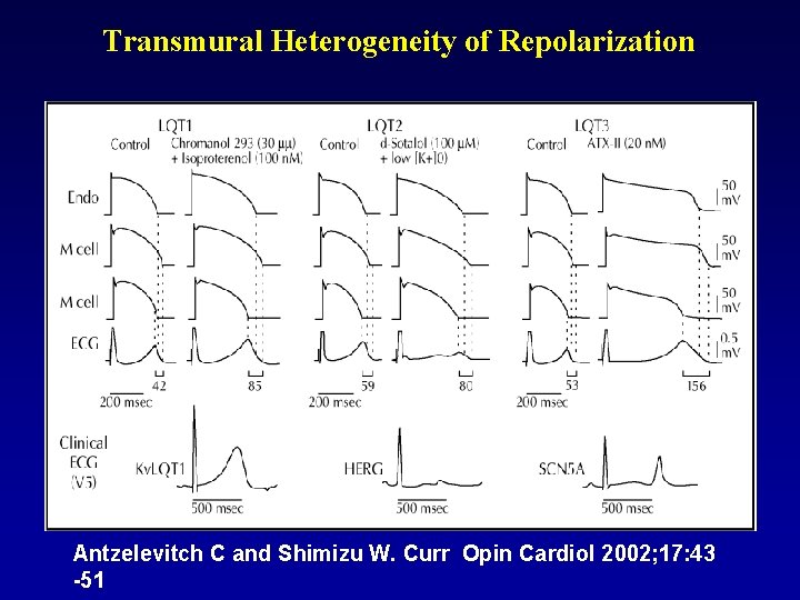 Transmural Heterogeneity of Repolarization Antzelevitch C and Shimizu W. Curr Opin Cardiol 2002; 17: