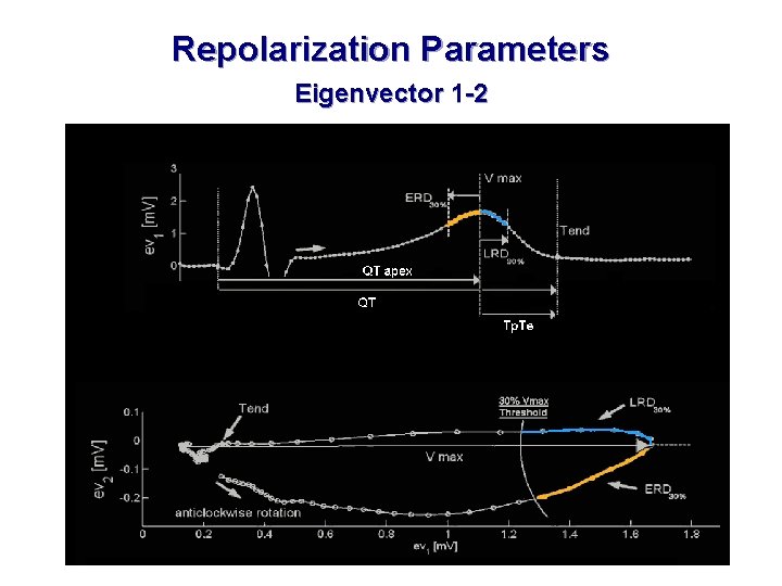 Repolarization Parameters Eigenvector 1 -2 