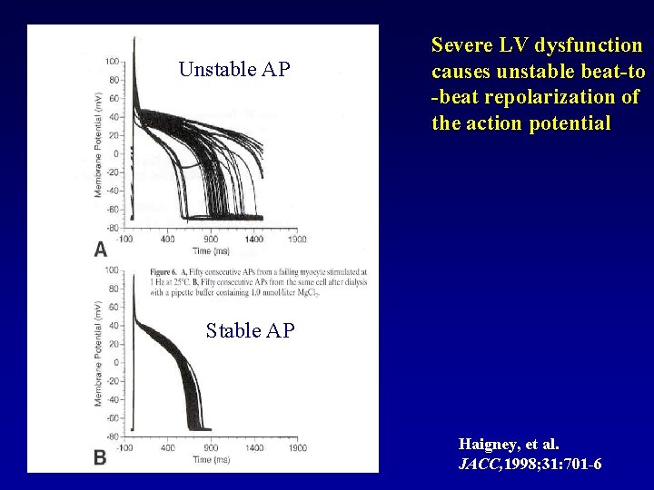 Unstable AP Severe LV dysfunction causes unstable beat-to -beat repolarization of the action potential