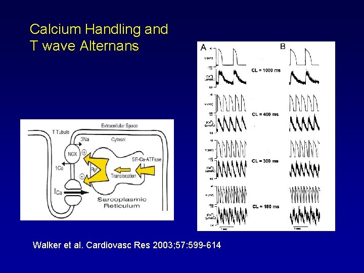 Calcium Handling and T wave Alternans Walker et al. Cardiovasc Res 2003; 57: 599