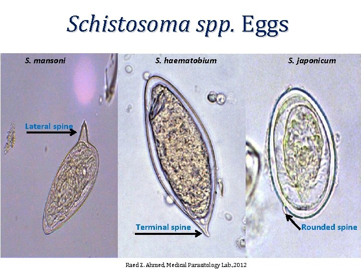 Schistosoma spp. Eggs S. mansoni S. haematobium S. japonicum Lateral spine Terminal spine Raed Schistosoma spp. Eggs S. mansoni S. haematobium S. japonicum Lateral spine Terminal spine Raed