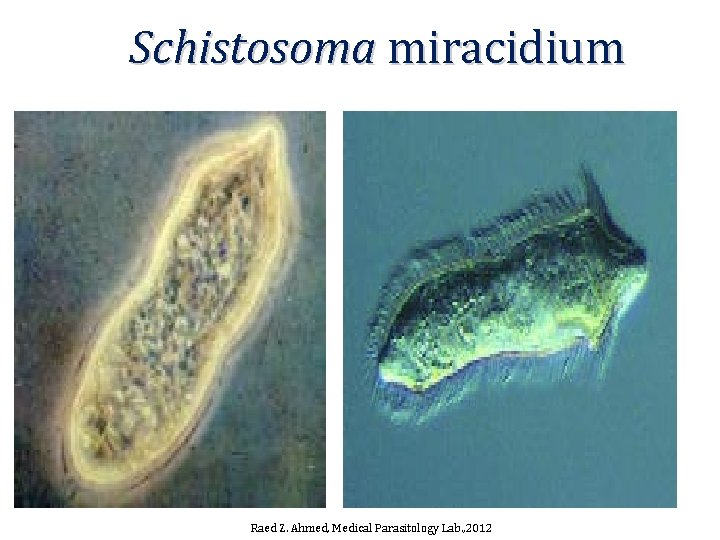 Schistosoma miracidium Raed Z. Ahmed, Medical Parasitology Lab. , 2012 Schistosoma miracidium Raed Z. Ahmed, Medical Parasitology Lab. , 2012