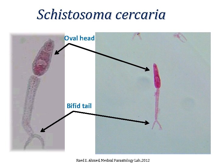 Schistosoma cercaria Oval head Bifid tail Raed Z. Ahmed, Medical Parasitology Lab. , 2012 Schistosoma cercaria Oval head Bifid tail Raed Z. Ahmed, Medical Parasitology Lab. , 2012