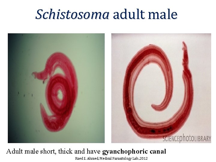 Schistosoma adult male Adult male short, thick and have gyanchophoric canal Raed Z. Ahmed, Schistosoma adult male Adult male short, thick and have gyanchophoric canal Raed Z. Ahmed,
