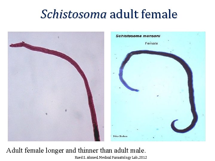Schistosoma adult female Adult female longer and thinner than adult male. Raed Z. Ahmed, Schistosoma adult female Adult female longer and thinner than adult male. Raed Z. Ahmed,