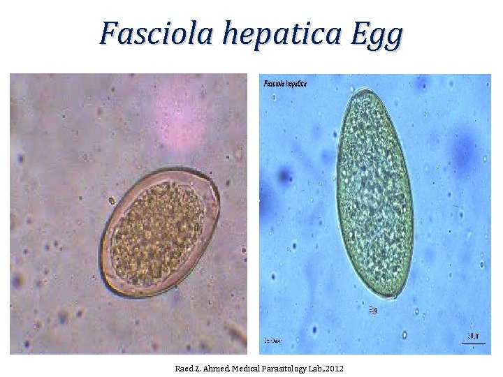 Fasciola hepatica Egg Raed Z. Ahmed, Medical Parasitology Lab. , 2012 Fasciola hepatica Egg Raed Z. Ahmed, Medical Parasitology Lab. , 2012