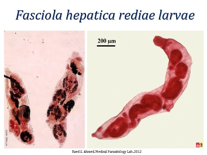 Fasciola hepatica rediae larvae Raed Z. Ahmed, Medical Parasitology Lab. , 2012 Fasciola hepatica rediae larvae Raed Z. Ahmed, Medical Parasitology Lab. , 2012