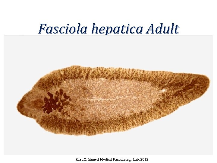 Fasciola hepatica Adult Raed Z. Ahmed, Medical Parasitology Lab. , 2012 Fasciola hepatica Adult Raed Z. Ahmed, Medical Parasitology Lab. , 2012