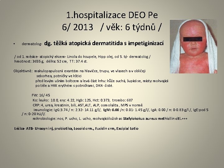 1. hospitalizace DEO Pe 6/ 2013 / věk: 6 týdnů / • dermatolog- dg.