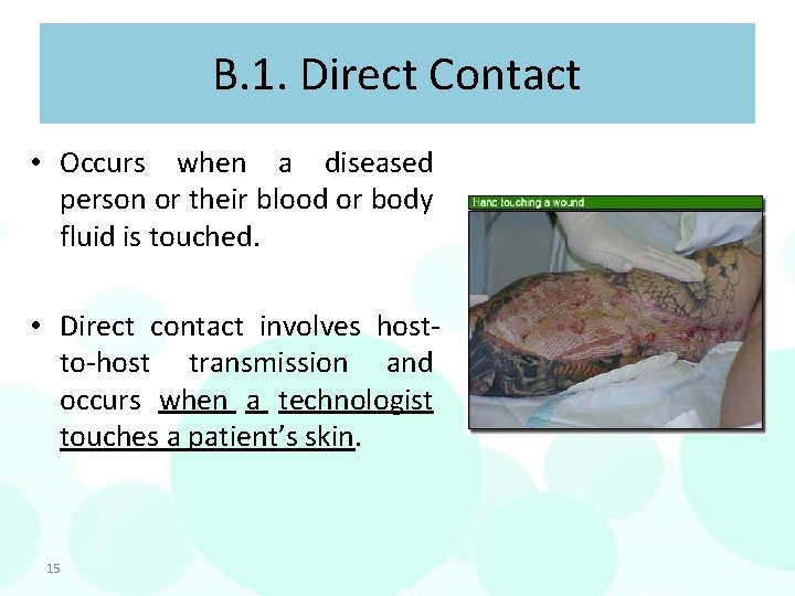 B. 1. Direct Contact • Occurs when a diseased person or their blood or