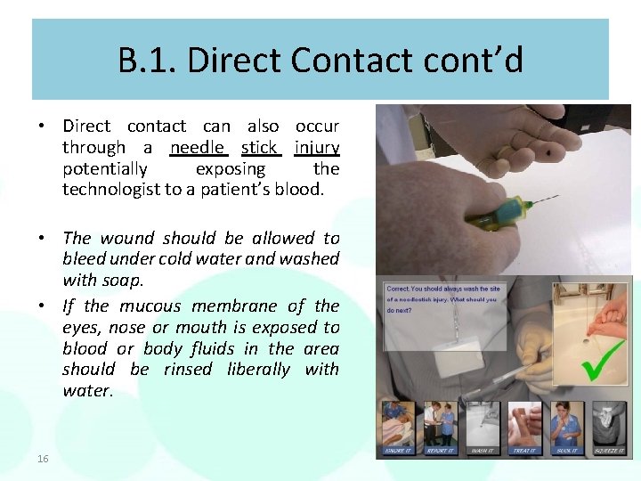 B. 1. Direct Contact cont’d • Direct contact can also occur through a needle