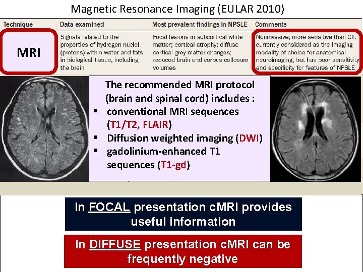 Magnetic Resonance Imaging (EULAR 2010) MRI The recommended MRI protocol (brain and spinal cord)