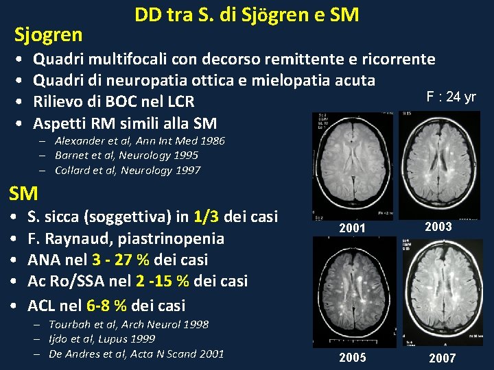 Sjogren • • DD tra S. di Sjögren e SM Quadri multifocali con decorso