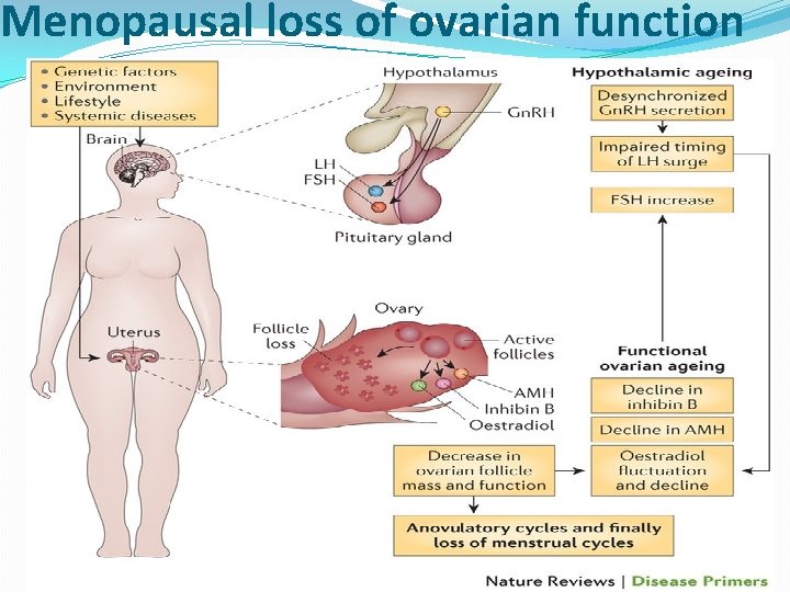 Menopausal loss of ovarian function 