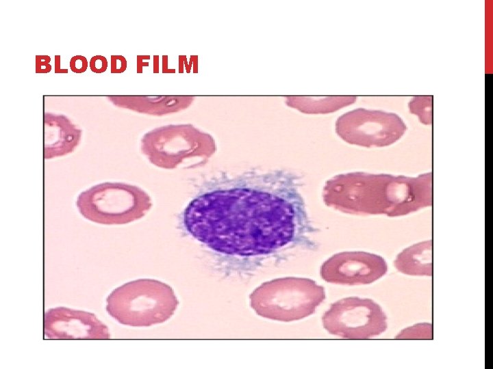 BLOOD FILM 