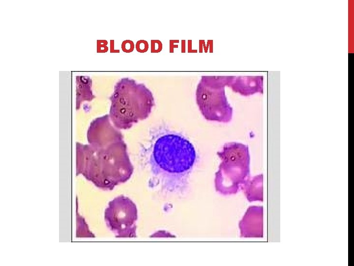 BLOOD FILM 