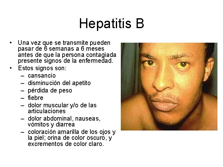 Hepatitis B • Una vez que se transmite pueden pasar de 6 semanas a