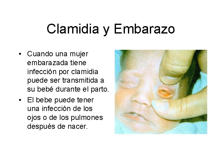 Clamidia y Embarazo • Cuando una mujer embarazada tiene infección por clamidia puede ser