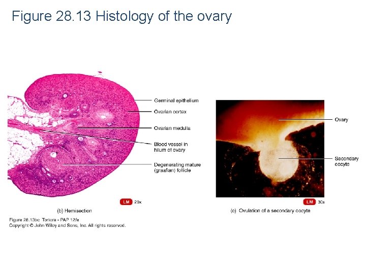 Figure 28. 13 Histology of the ovary 