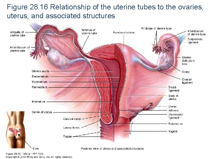 Figure 28. 16 Relationship of the uterine tubes to the ovaries, uterus, and associated