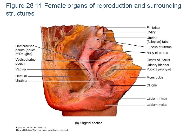 Figure 28. 11 Female organs of reproduction and surrounding structures 